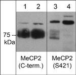 Phospho-MECP2 (Ser421) Antibody in Western Blot (WB)