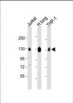 CD31 Antibody in Western Blot (WB)
