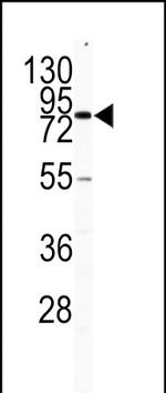 CD31 Antibody in Western Blot (WB)