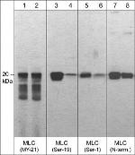 MYL9/MYL12 Antibody in Western Blot (WB)