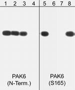 Phospho-PAK6 (Ser165) Polyclonal Antibody