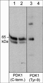 Phospho-PDPK1 (Tyr9) Antibody in Western Blot (WB)