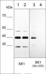 Phospho-SPHK1 (Ser225) Antibody in Western Blot (WB)
