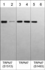 Phospho-TRPM7 (Ser1493) Antibody in Western Blot (WB)