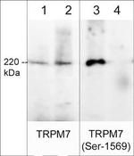 Phospho-TRPM7 (Ser1569) Polyclonal Antibody