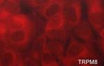 TRPM8 Polyclonal Antibody