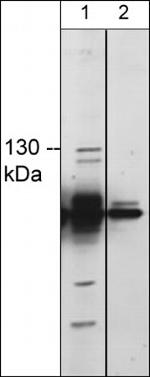 TRPM8 Antibody in Western Blot (WB)