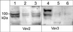 VAV3 Antibody in Western Blot (WB)