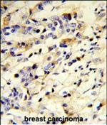 Rabbit anti-Human IgM Secondary Antibody