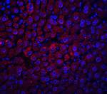 Albumin Polyclonal Antibody