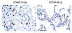 SARS-CoV-2 NSP14 Antibody in Immunohistochemistry (Paraffin) (IHC (P))
