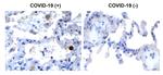 SARS-CoV-2 NSP13 Polyclonal Antibody