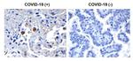 SARS-CoV-2 NSP13 Antibody in Immunohistochemistry (Paraffin) (IHC (P))