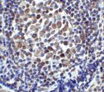 CD223 Antibody in Immunohistochemistry (Paraffin) (IHC (P))