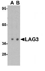 CD223 Antibody in Western Blot (WB)