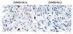 SARS-CoV-2 NSP2 Polyclonal Antibody