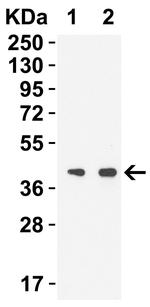 SARS-CoV-2 NSP15 Polyclonal Antibody
