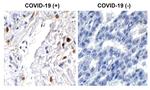 SARS-CoV-2 ORF7a Polyclonal Antibody