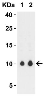 SARS-CoV-2 ORF9c Polyclonal Antibody