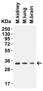 TMEM41B Antibody in Western Blot (WB)