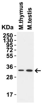TMEM41B Antibody in Western Blot (WB)