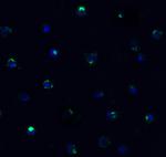 TMPRSS2 Polyclonal Antibody