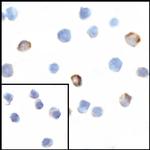 VISTA Polyclonal Antibody