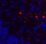 VISTA Antibody in Immunohistochemistry (Paraffin) (IHC (P))