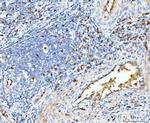 HBA1/HBA2 Polyclonal Antibody
