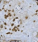 Fibrinogen alpha chain Polyclonal Antibody