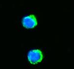 NNT Polyclonal Antibody