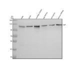 NNT Antibody in Western Blot (WB)