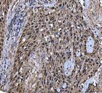 Twist1/Twist2 Antibody in Immunohistochemistry (Paraffin) (IHC (P))