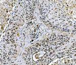 Twist1/Twist2 Polyclonal Antibody
