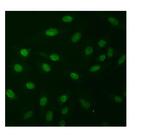 NPR1 Polyclonal Antibody