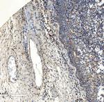 COL7A1 Antibody in Immunohistochemistry (Paraffin) (IHC (P))