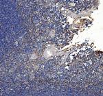 COL7A1 Antibody in Immunohistochemistry (Paraffin) (IHC (P))