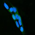 LPO Polyclonal Antibody