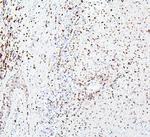 CRB1 Polyclonal Antibody