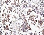 CRB1 Antibody in Immunohistochemistry (Paraffin) (IHC (P))