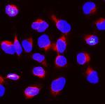 BUBR1 Polyclonal Antibody