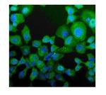 NPC2 Polyclonal Antibody