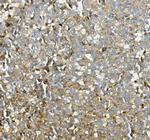 ASAH1 Antibody in Immunohistochemistry (Paraffin) (IHC (P))