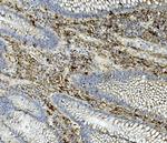 ASAH1 Antibody in Immunohistochemistry (Paraffin) (IHC (P))