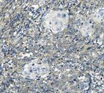 PHEX Antibody in Immunohistochemistry (Paraffin) (IHC (P))