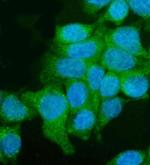 UTRN Polyclonal Antibody