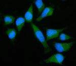 GNB3 Polyclonal Antibody