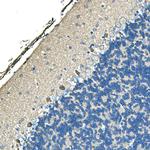 Ankyrin 1 Antibody in Immunohistochemistry (Paraffin) (IHC (P))