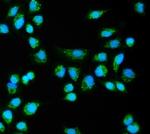 CLPB Polyclonal Antibody