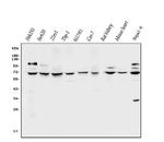 CLPB Antibody in Western Blot (WB)